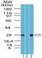 Interleukin 1 Receptor Like 1 antibody, PA5-23206, Invitrogen Antibodies, Western Blot image 