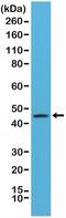 Keratin 20 antibody, NBP2-61523, Novus Biologicals, Western Blot image 