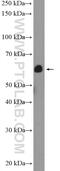 Calreticulin antibody, 10292-1-AP, Proteintech Group, Western Blot image 