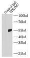 PDZ And LIM Domain 7 antibody, FNab06285, FineTest, Immunoprecipitation image 