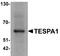 Thymocyte Expressed, Positive Selection Associated 1 antibody, A09477, Boster Biological Technology, Western Blot image 
