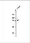 Carbonic Anhydrase 1 antibody, PA5-72420, Invitrogen Antibodies, Western Blot image 