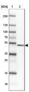 Family With Sequence Similarity 155 Member A antibody, NBP1-90982, Novus Biologicals, Western Blot image 