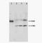 MAS Related GPR Family Member X1 antibody, PA1208, Boster Biological Technology, Western Blot image 