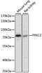 Protein Kinase C Zeta antibody, 15-411, ProSci, Western Blot image 