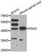 Paired Box 2 antibody, LS-C332346, Lifespan Biosciences, Western Blot image 