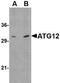 Autophagy Related 12 antibody, NBP1-76860, Novus Biologicals, Western Blot image 