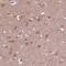 Zinc Finger Protein 292 antibody, PA5-65628, Invitrogen Antibodies, Immunohistochemistry paraffin image 