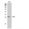 CMTM4 antibody, LS-C382774, Lifespan Biosciences, Western Blot image 