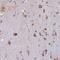 Beta-Secretase 2 antibody, HPA035416, Atlas Antibodies, Immunohistochemistry paraffin image 