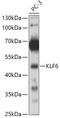 Kruppel Like Factor 6 antibody, 13-372, ProSci, Western Blot image 