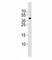 ISL LIM Homeobox 1 antibody, F52956-0.4ML, NSJ Bioreagents, Western Blot image 