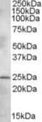 Pleckstrin Homology Domain Containing B1 antibody, PA5-19042, Invitrogen Antibodies, Western Blot image 