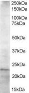 Ubiquitin Conjugating Enzyme E2 K antibody, orb94074, Biorbyt, Western Blot image 