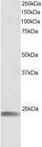 Heat Shock Protein Family B (Small) Member 8 antibody, TA302835, Origene, Western Blot image 