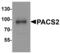 Phosphofurin Acidic Cluster Sorting Protein 2 antibody, MBS153374, MyBioSource, Western Blot image 