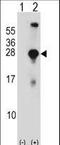 Synaptosome Associated Protein 23 antibody, LS-C161337, Lifespan Biosciences, Western Blot image 
