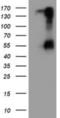 Serine Peptidase Inhibitor, Kunitz Type 1 antibody, NBP2-01969, Novus Biologicals, Western Blot image 