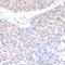 Mediator Complex Subunit 1 antibody, NB100-2574, Novus Biologicals, Immunohistochemistry paraffin image 