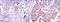 Nuclear Factor Kappa B Subunit 1 antibody, NBP2-22178, Novus Biologicals, Immunohistochemistry paraffin image 