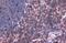 Linker For Activation Of T Cells antibody, GTX104771, GeneTex, Immunohistochemistry paraffin image 