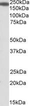 IQ Motif Containing GTPase Activating Protein 1 antibody, EB09580, Everest Biotech, Western Blot image 