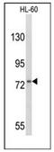 Colony Stimulating Factor 3 Receptor antibody, AP51098PU-N, Origene, Western Blot image 