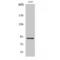 Ribosomal Protein S6 Kinase A5 antibody, LS-C384686, Lifespan Biosciences, Western Blot image 