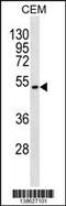 Target Of Myb1 Like 2 Membrane Trafficking Protein antibody, 60-058, ProSci, Western Blot image 