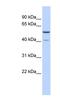 Methyltransferase Like 15 antibody, NBP1-55023, Novus Biologicals, Western Blot image 