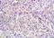 Natural Cytotoxicity Triggering Receptor 2 antibody, orb13334, Biorbyt, Immunohistochemistry paraffin image 