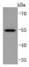 Matrix Metallopeptidase 13 antibody, A00420-1, Boster Biological Technology, Western Blot image 