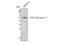Transforming Growth Factor Beta Receptor 2 antibody, STJ95993, St John