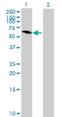 MAGE Family Member B6 antibody, H00158809-B01P, Novus Biologicals, Western Blot image 