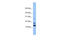 C1D Nuclear Receptor Corepressor antibody, 30-630, ProSci, Western Blot image 