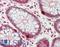 Cyclin Dependent Kinase 6 antibody, LS-B12388, Lifespan Biosciences, Immunohistochemistry paraffin image 
