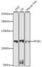 Adaptor Related Protein Complex 1 Subunit Beta 1 antibody, 16-538, ProSci, Western Blot image 