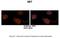 SET Nuclear Proto-Oncogene antibody, A02211, Boster Biological Technology, Immunohistochemistry paraffin image 