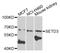 SET Domain Containing 3, Actin Histidine Methyltransferase antibody, A10965, Boster Biological Technology, Western Blot image 