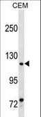 Myocardin Related Transcription Factor A antibody, LS-C158145, Lifespan Biosciences, Western Blot image 