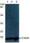 Cyclin Dependent Kinase Inhibitor 2B antibody, PA5-75177, Invitrogen Antibodies, Western Blot image 