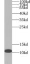 Ubiquinol-Cytochrome C Reductase, Complex III Subunit X antibody, FNab09231, FineTest, Western Blot image 