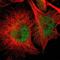 Endoglin antibody, NBP1-91212, Novus Biologicals, Immunocytochemistry image 
