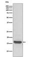 Microtubule Associated Protein 1 Light Chain 3 Alpha antibody, M01543, Boster Biological Technology, Western Blot image 