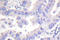 Spleen Associated Tyrosine Kinase antibody, LS-C176304, Lifespan Biosciences, Immunohistochemistry paraffin image 