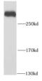 Pre-MRNA Processing Factor 8 antibody, FNab06821, FineTest, Western Blot image 