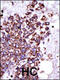 Calcium/Calmodulin Dependent Protein Kinase I antibody, 62-731, ProSci, Immunofluorescence image 