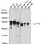 Aldehyde Dehydrogenase 1 Family Member B1 antibody, GTX32998, GeneTex, Western Blot image 