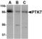 Protein-tyrosine kinase 7 antibody, A02957-1, Boster Biological Technology, Western Blot image 