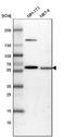Malic Enzyme 3 antibody, NBP1-85871, Novus Biologicals, Western Blot image 